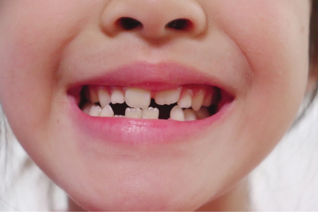子どもの歯が生えてくる時期と順番