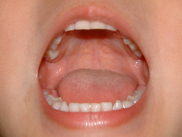 子どもの歯と大人の歯の違いをご存知ですか？