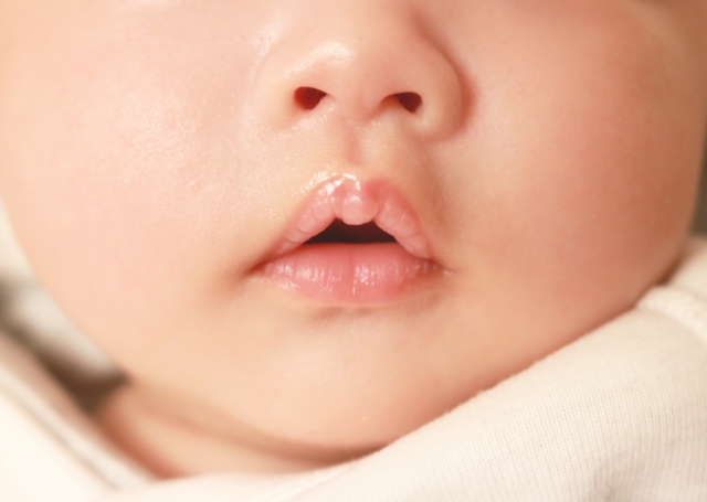 幼児の口呼吸に潜むリスクについて