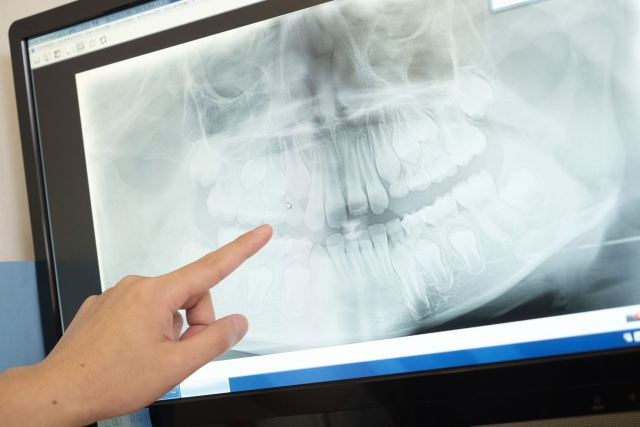 乳歯の特徴と永久歯との違いについて