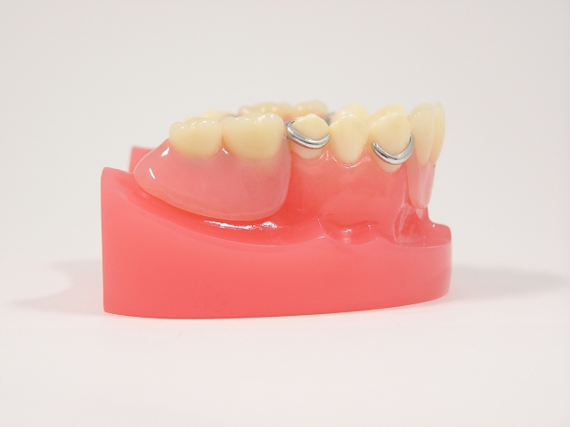 子どもの歯科治療で入れ歯を使うことがある？